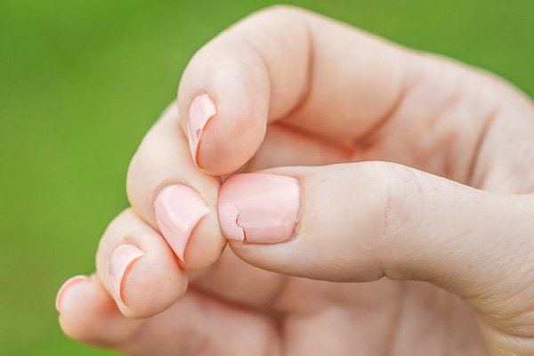 Damaged Thumb Nail